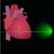 Atrial Fibrillation related image